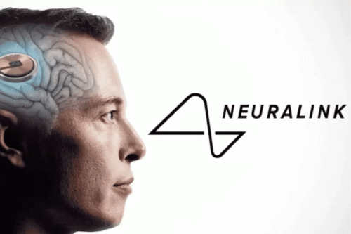 Paciente com implante Neuralink consegue digitar com o pensamento usando IA de Musk